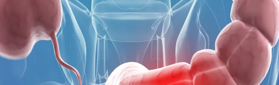 Cáncer de Colon Tratamiento Natural Tratamiento Natural del Cáncer De Colon