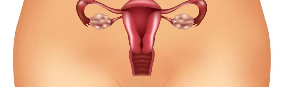 Tratamiento natural del Ovario poliquístico Ovario poliquístico tratamiento natural