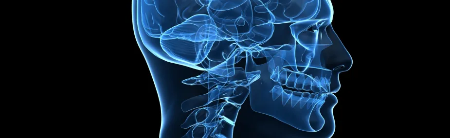 Tratamiento Natural para Glioblastoma Tratamiento Natural para Tumor cerebral