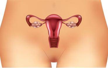 Ovario poliquístico tratamiento natural